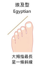 埃及腳推薦鞋款